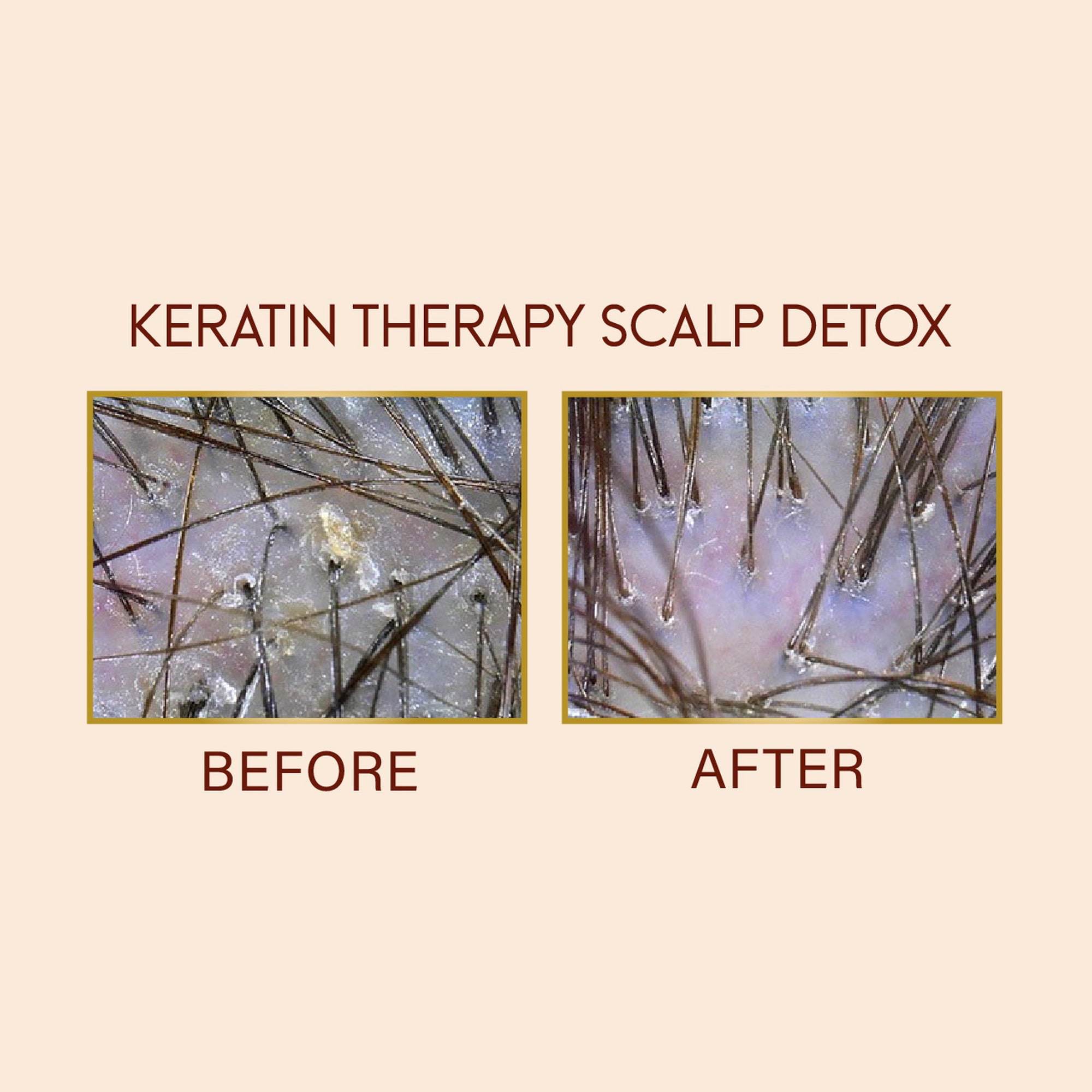 Keratin Therapy Scalp Detox