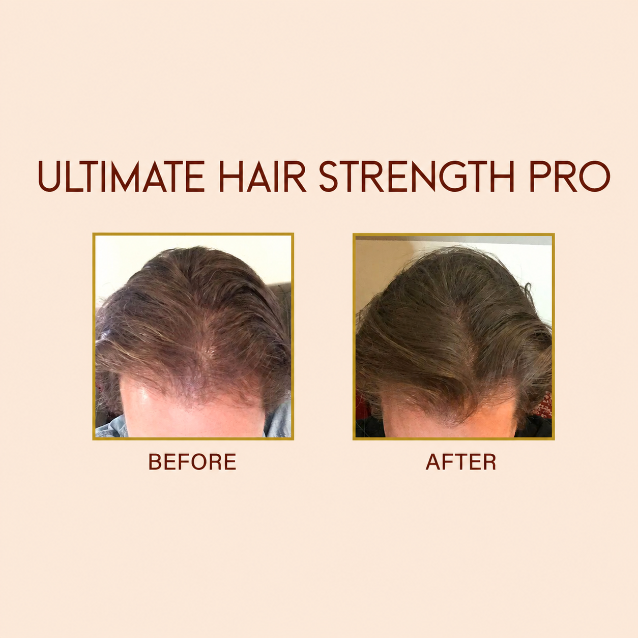 Ultimate Hair Strength PRO Supplements- 90 Days
