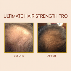 Ultimate Hair Strength PRO Supplements- 90 Days