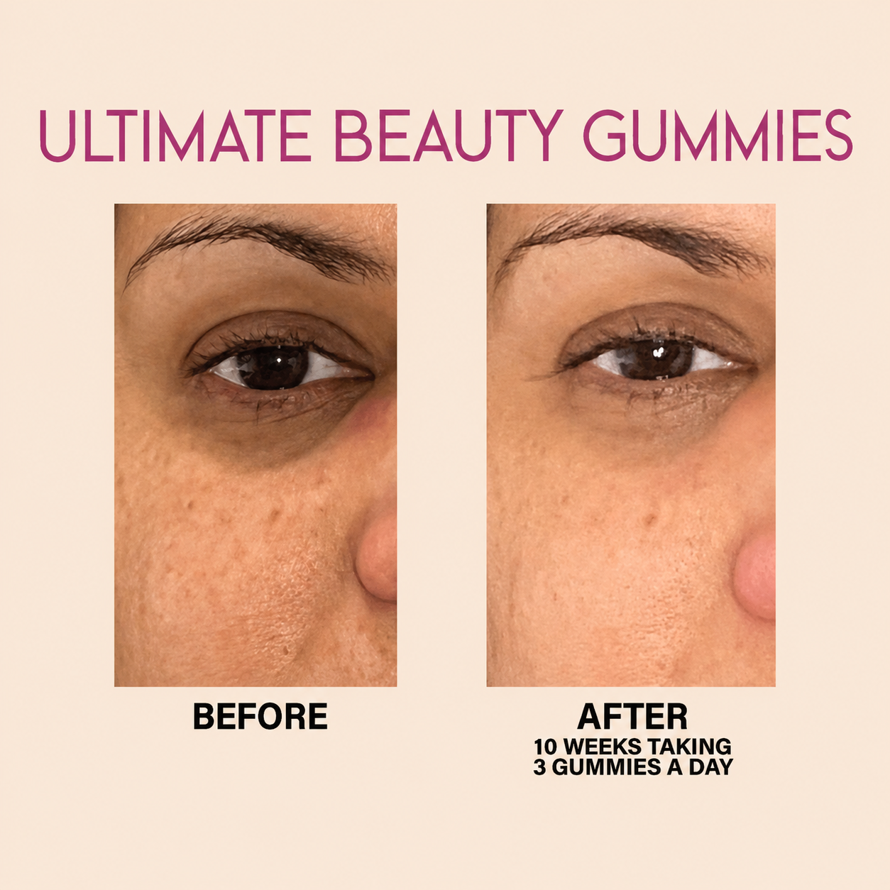 Ultimate Beauty Gummies 90-DAYS