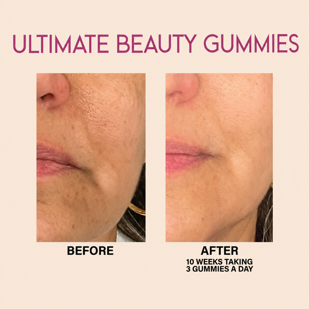 Ultimate Beauty Gummies 90-DAYS