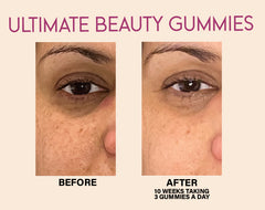 Ultimate Beauty Gummies 30-DAYS
