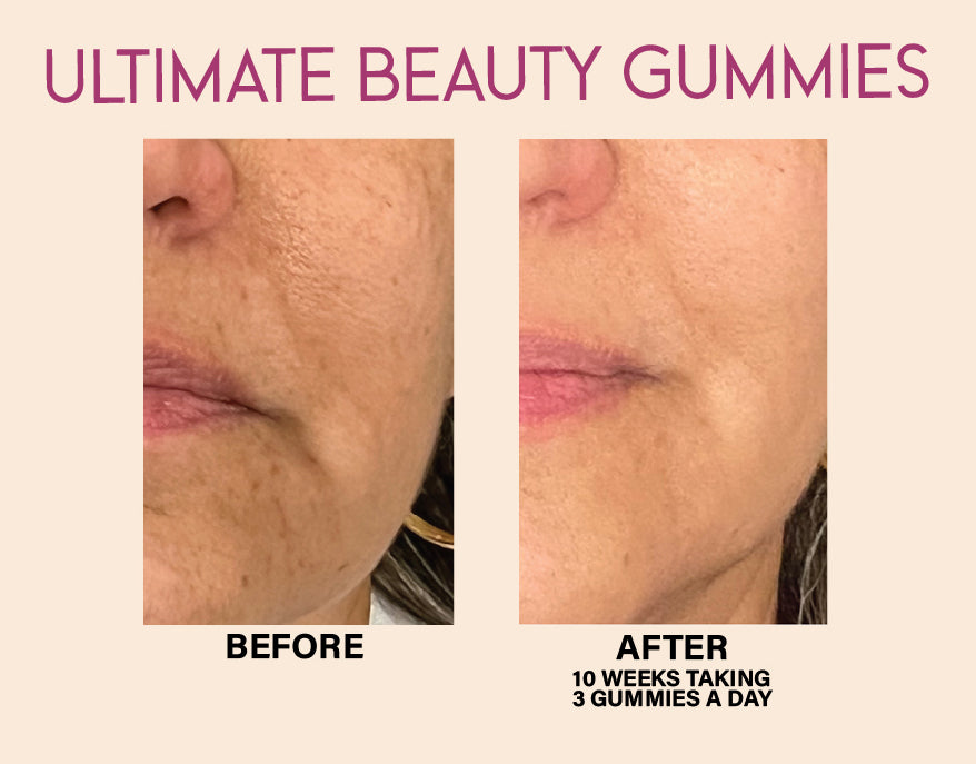 Ultimate Beauty Gummies 30-DAYS