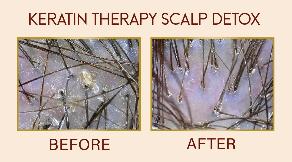 Keratin Therapy Scalp Detox 90 DAYS