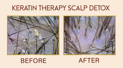 Keratin Therapy Scalp Detox 90 DAYS