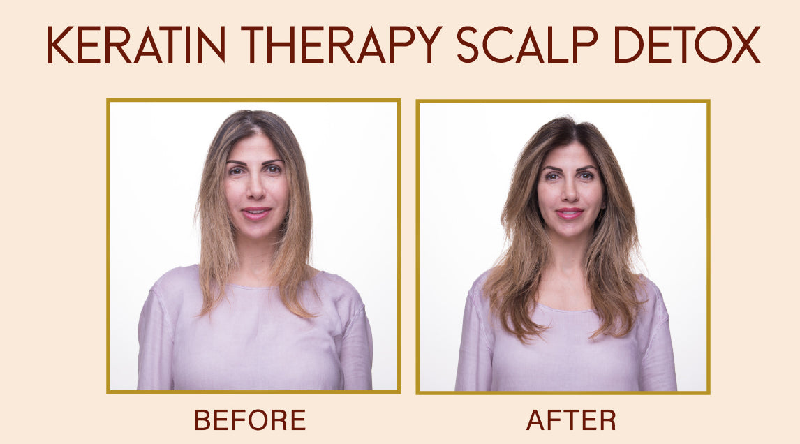 Keratin Therapy Scalp Detox 90 DAYS