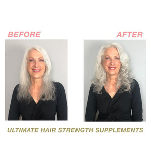 
            
                Load image into Gallery viewer, Ultimate Hair Strength PRO Supplements 30 Days
            
        