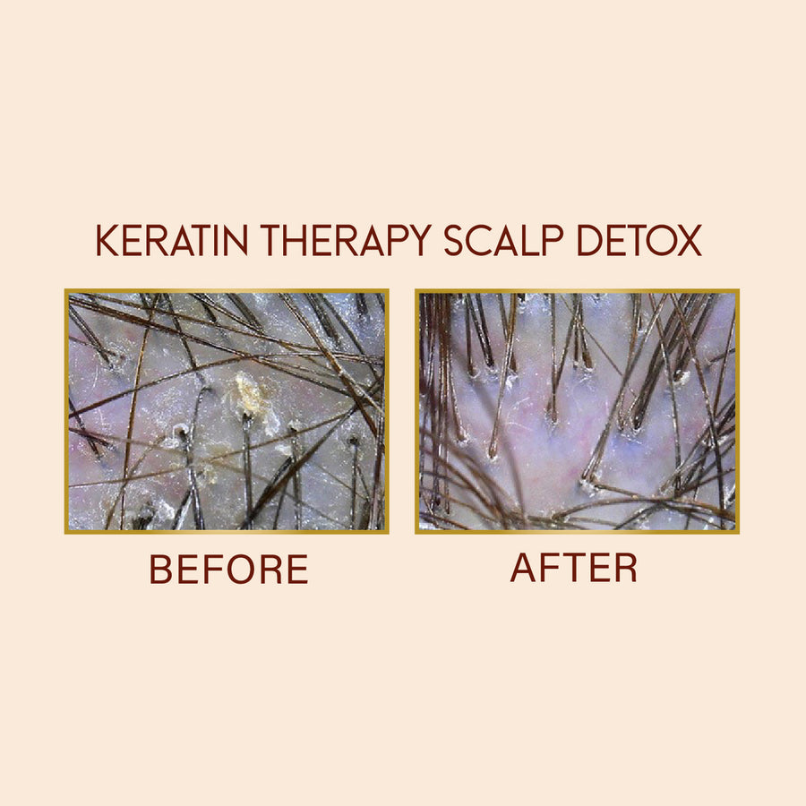 Keratin Therapy Scalp Detox