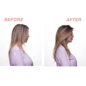 
            
                Load image into Gallery viewer, Keratin Therapy Scalp Detox
            
        