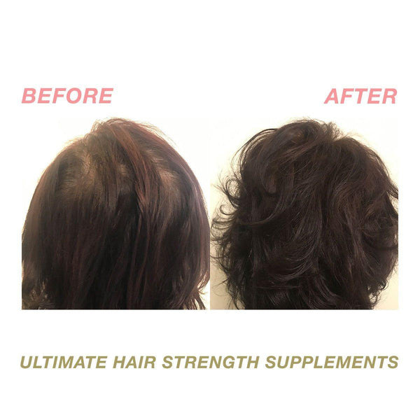 Ultimate Hair Strength Hair Supplements - 3