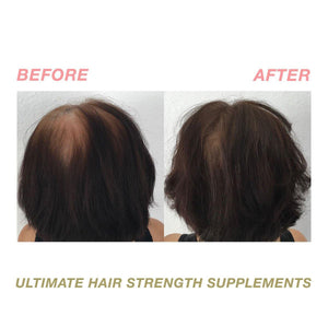 
            
                Load image into Gallery viewer, Ultimate Hair Strength Hair Supplements - 4
            
        