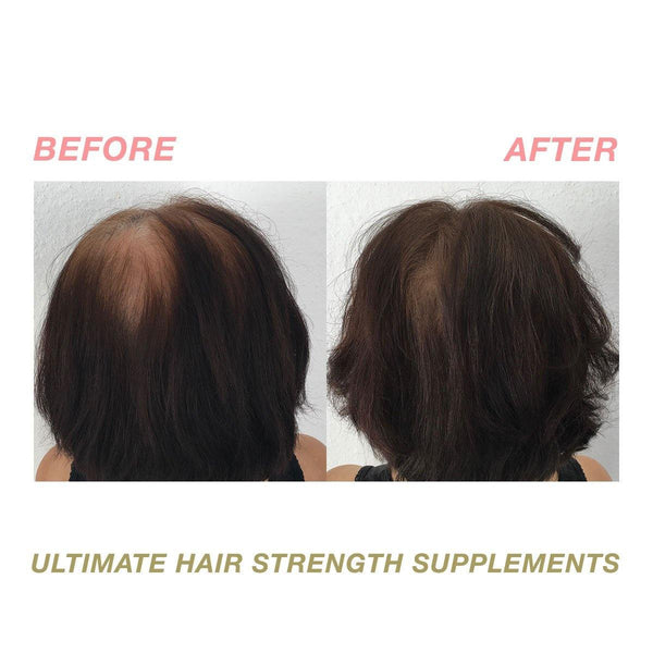 Ultimate Hair Strength Hair Supplements - 4