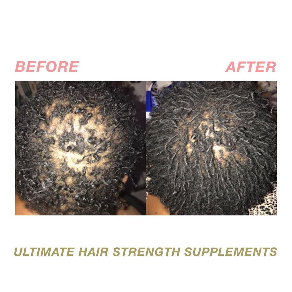Ultimate Hair Strength Hair Supplements - 5