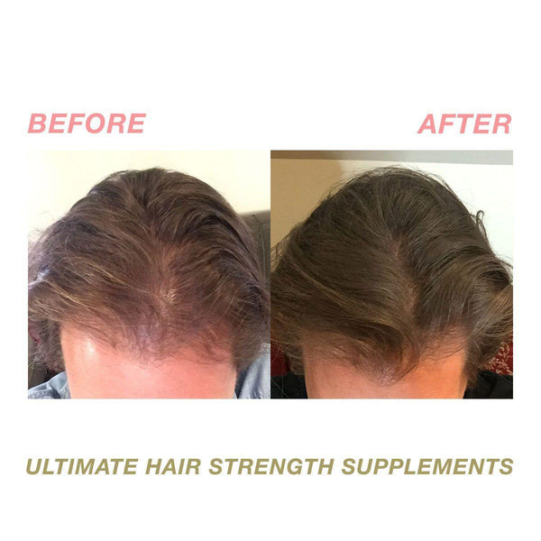 Ultimate Hair Strength Hair Supplements - 2